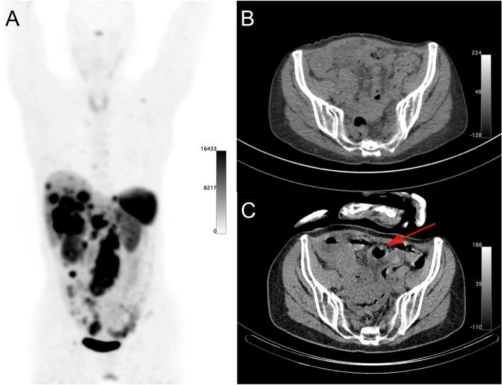 Fig. 4