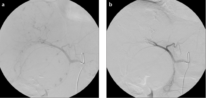 Figure 2. a, b.