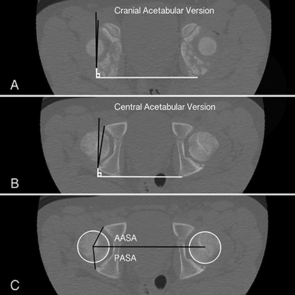 Fig. 3 A-C