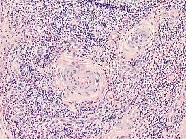 Fig. 6