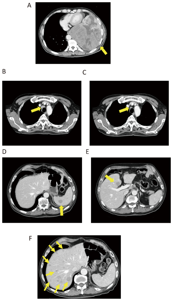 Fig. 7