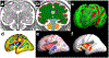 Fig 4