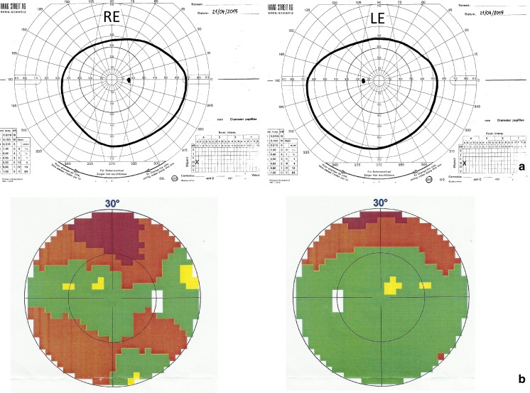 Fig. 3