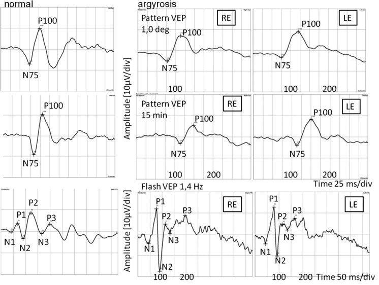 Fig. 5