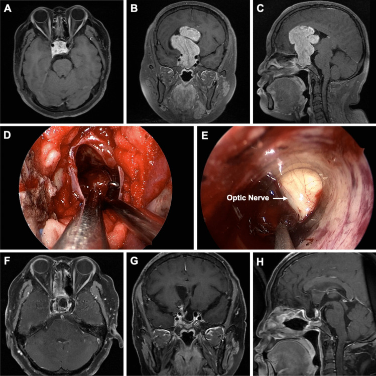 Fig. 3