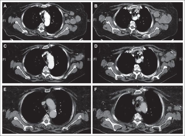 Fig 2.