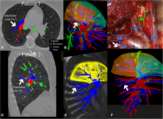 Figure 1