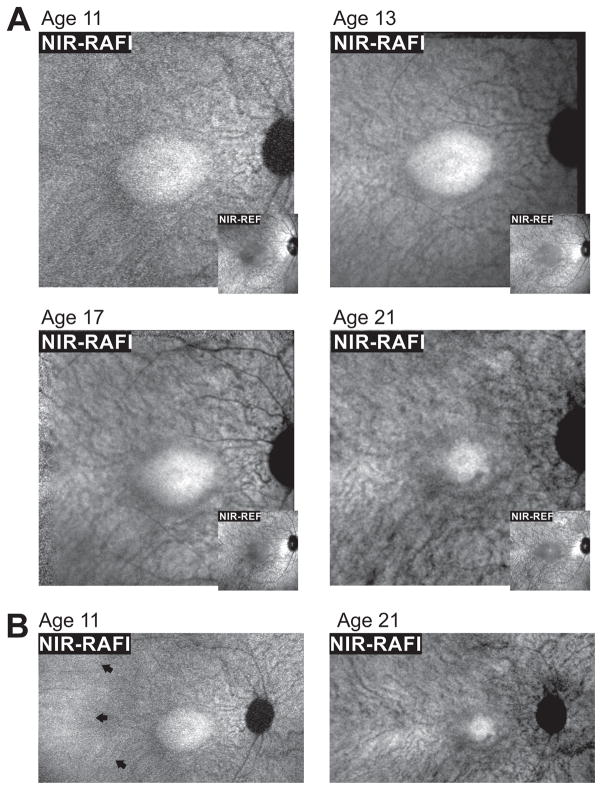 FIGURE 3