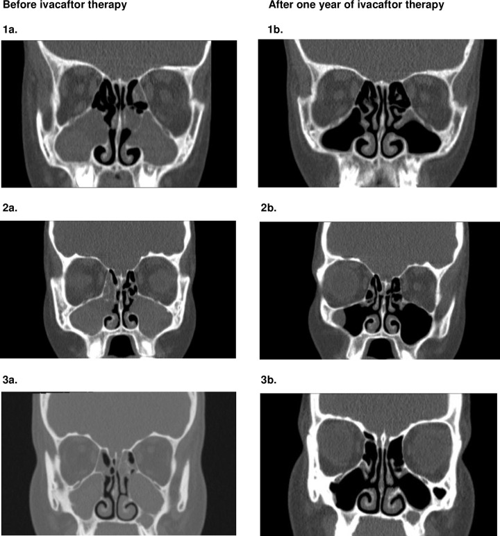 Fig 1