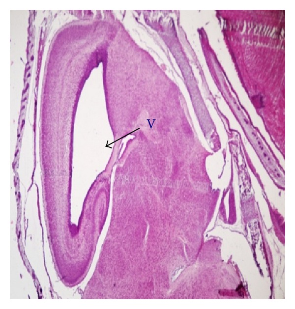 Figure 10