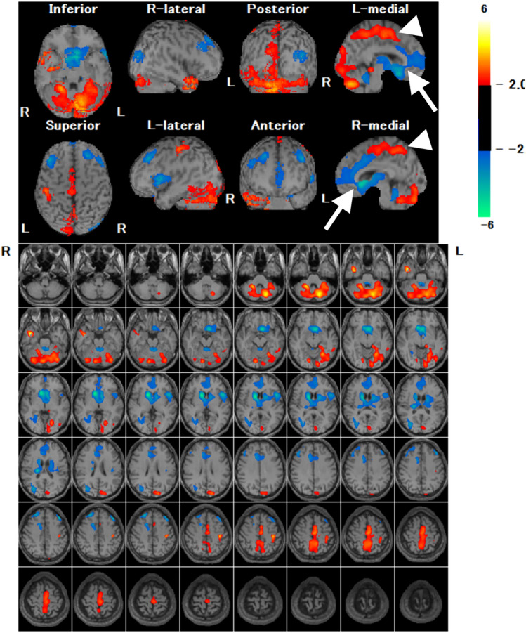 Fig. 10