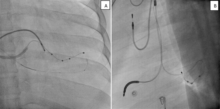 Fig. 4