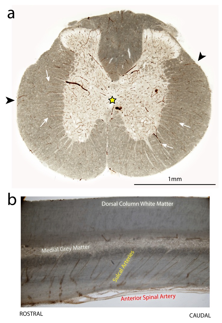 Figure 11. 