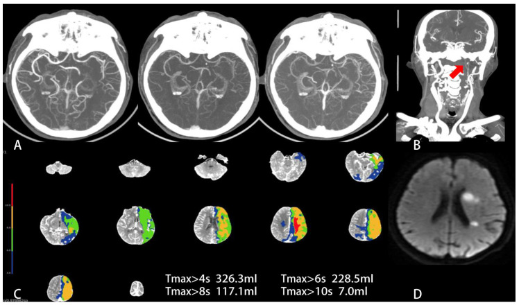 Figure 2