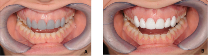 Fig. 5