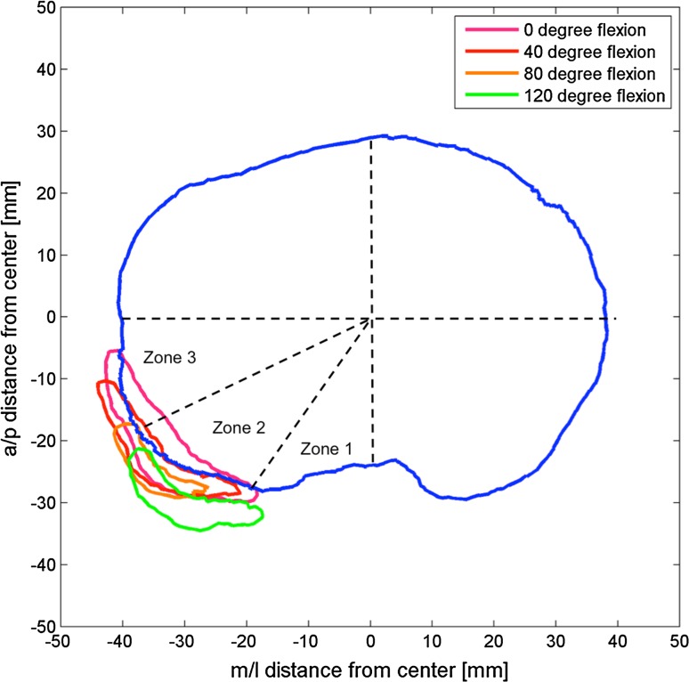 Fig. 9