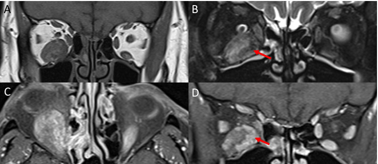 Fig. 13