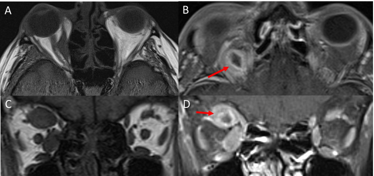 Fig. 11