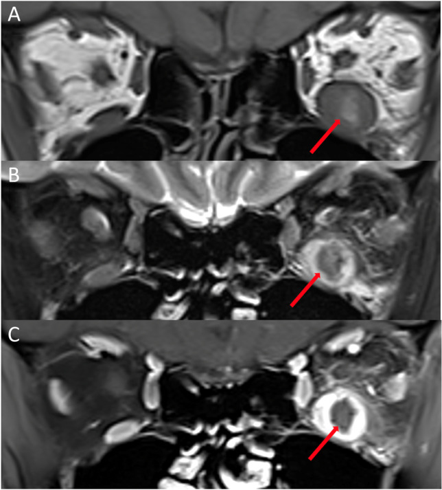 Fig. 12