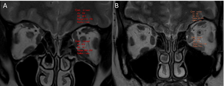 Fig. 5