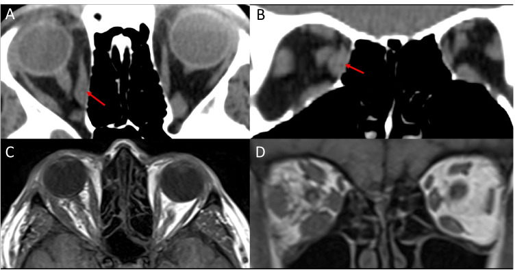 Fig. 10