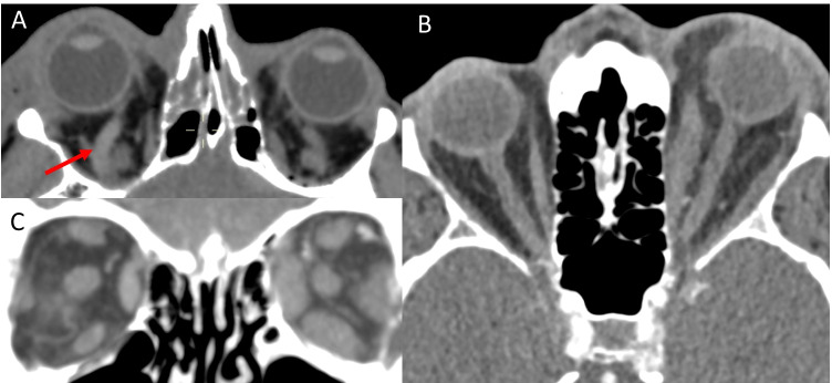 Fig. 14