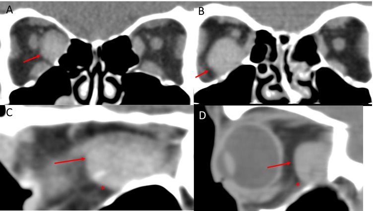 Fig. 15