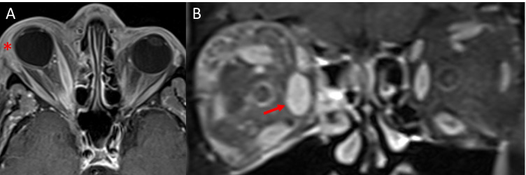 Fig. 17