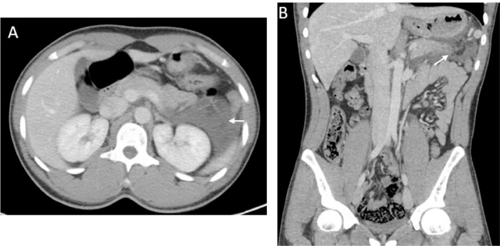 Fig 2