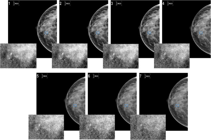 Fig. 4