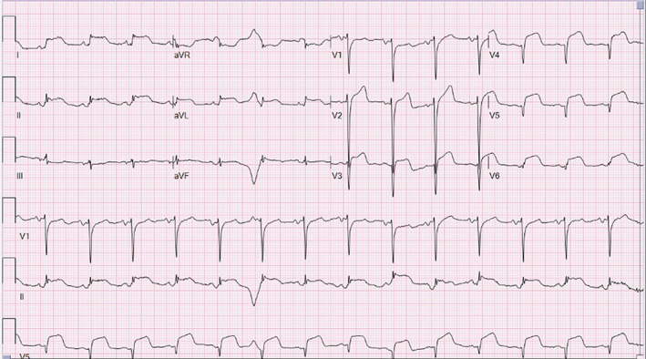 FIGURE 1