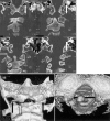 Fig. 4 a