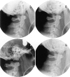 Fig. 5