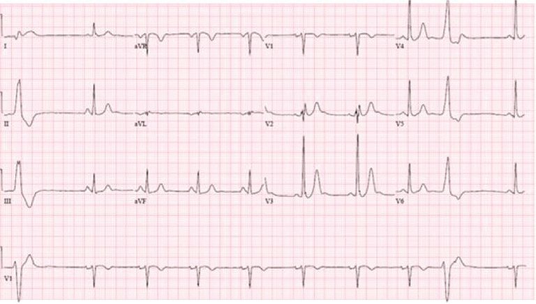 Figure 1: