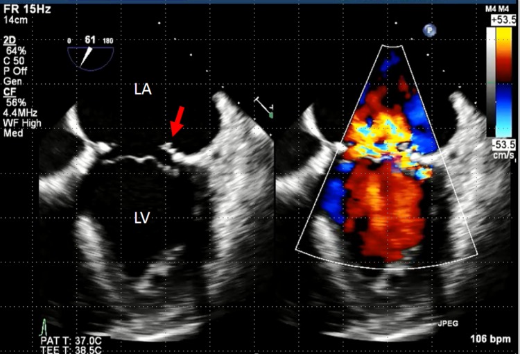 Figure 1