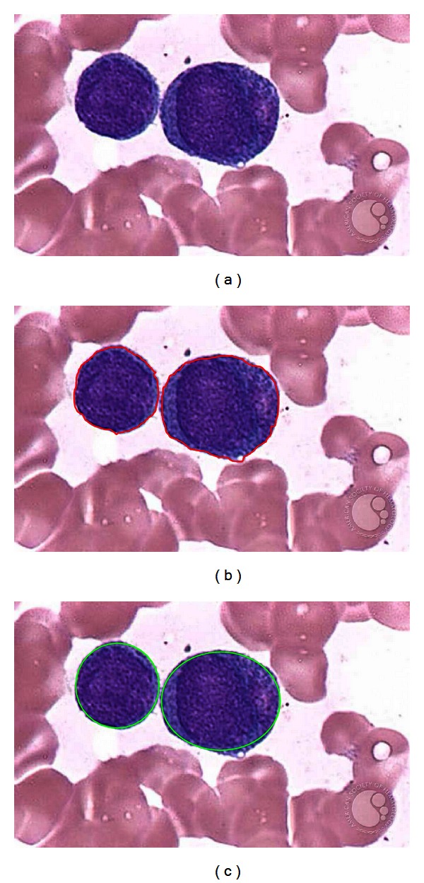 Figure 11