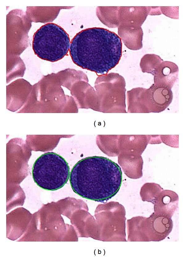 Figure 12