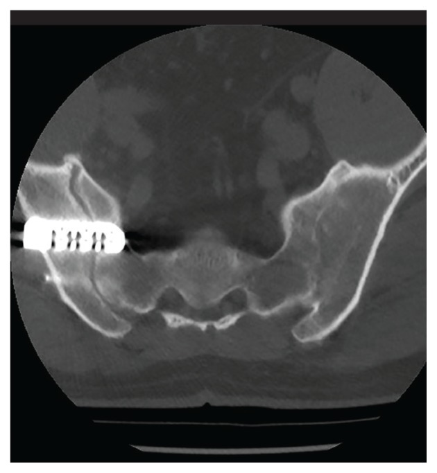 FIGURE 4