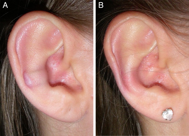 Figure 11.