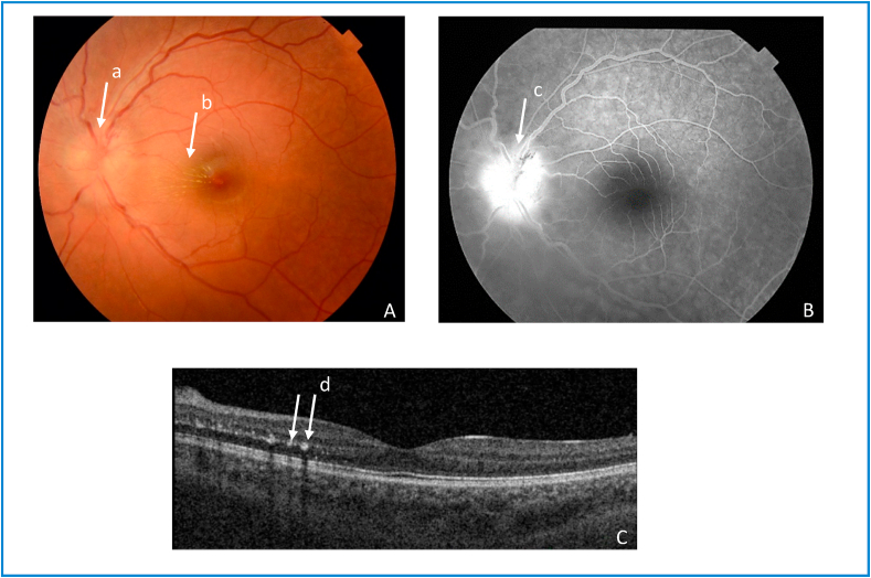 Fig. 1