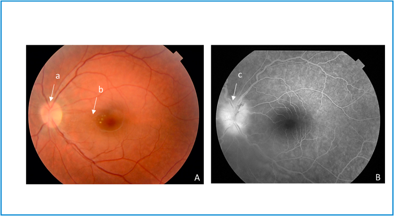 Fig. 2