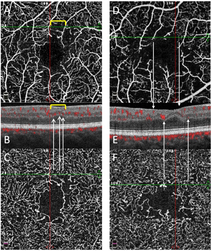 Fig 6