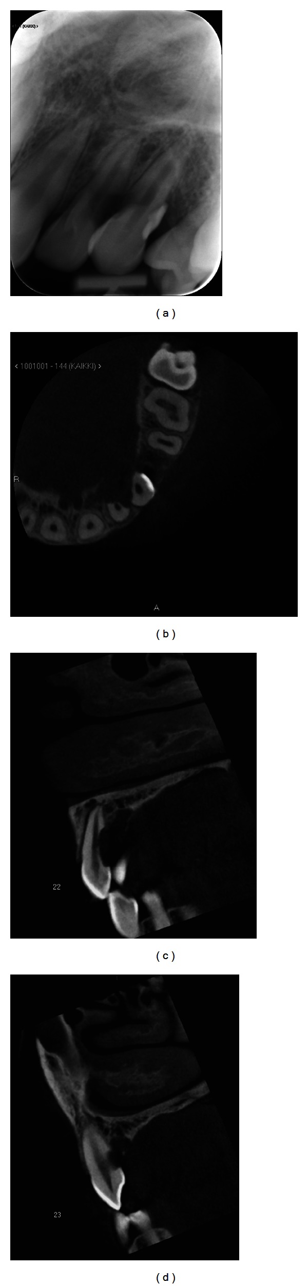 Figure 2