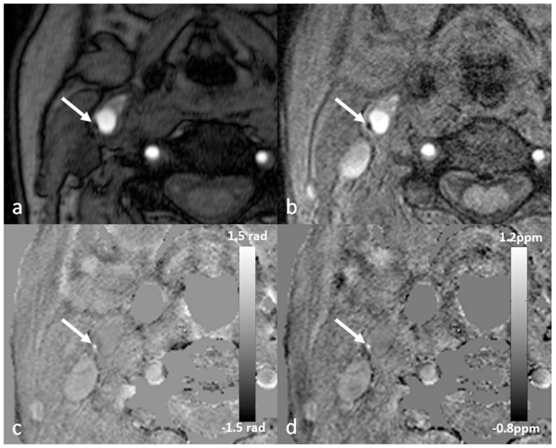 Figure 14