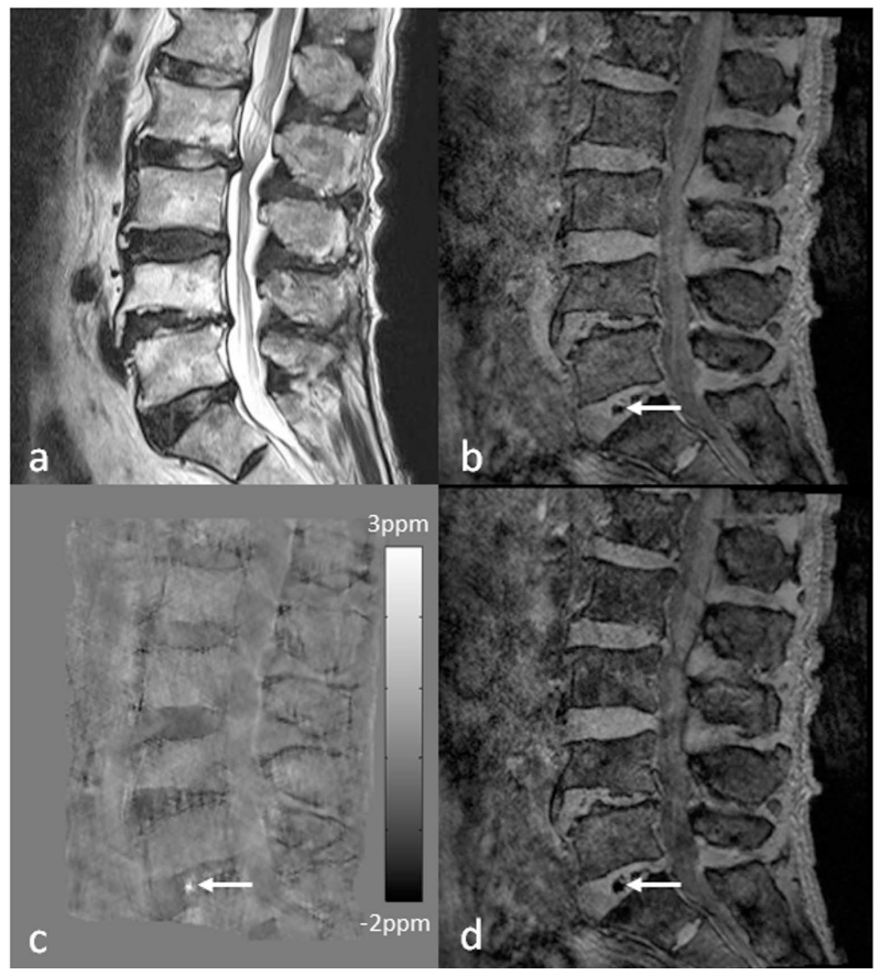 Figure 17