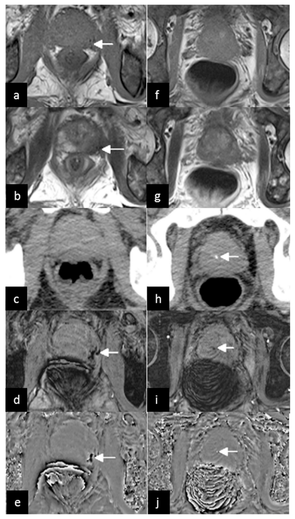 Figure 16