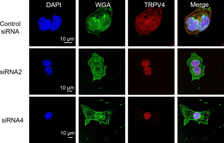 Figure 1—figure supplement 4.