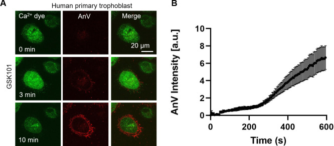 Figure 2—figure supplement 1.