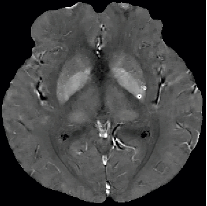 Figure 2a: