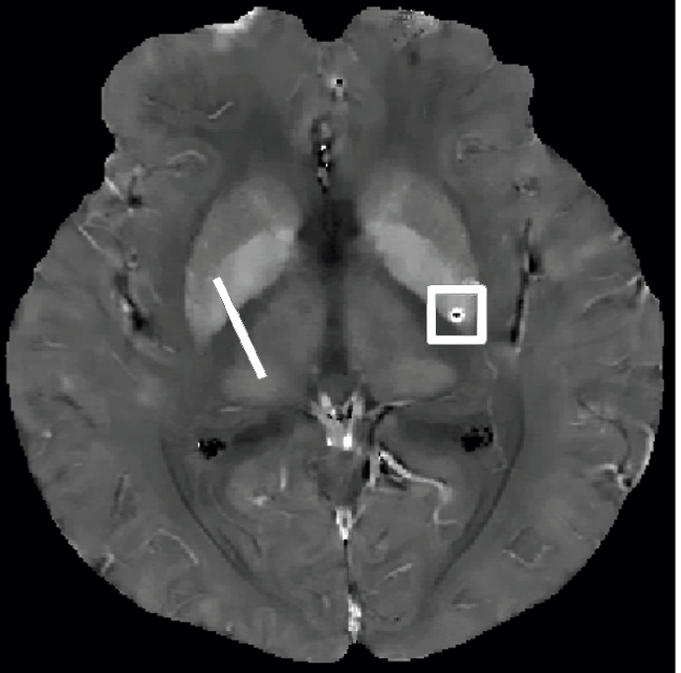 Figure 2b: